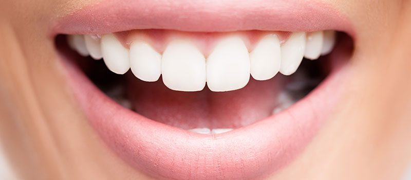 Close up of a Person with even gums